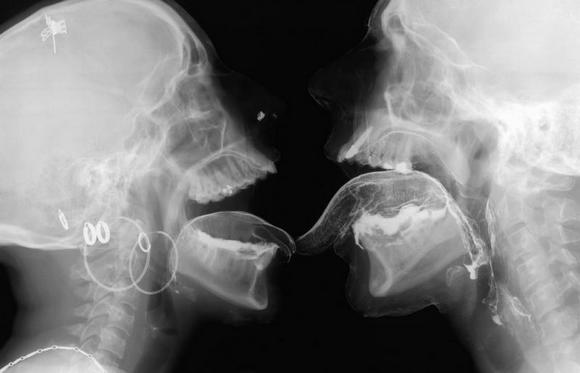 Рентген как развлечение | Пикабу