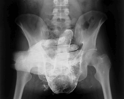 Рентген | Порно Видео рентген